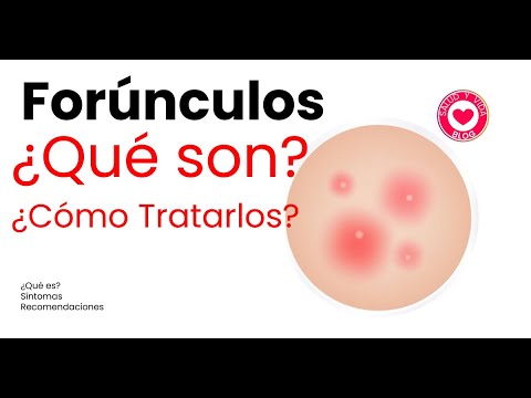 Los forúnculos qué son y cómo tratarlos