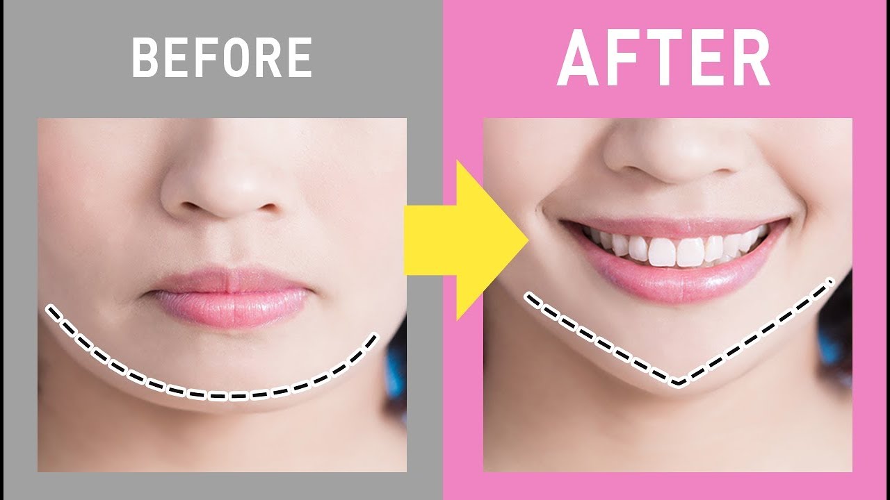 【顔の印象が変わる】フェイスラインをすっきりさせる方法。1週間で効果を実感! YouTube 【顔の印象が変わる】フェイスラインをすっきりさせる方法。1週間で効果を実感! YouTube