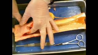 Long Bone Dissection