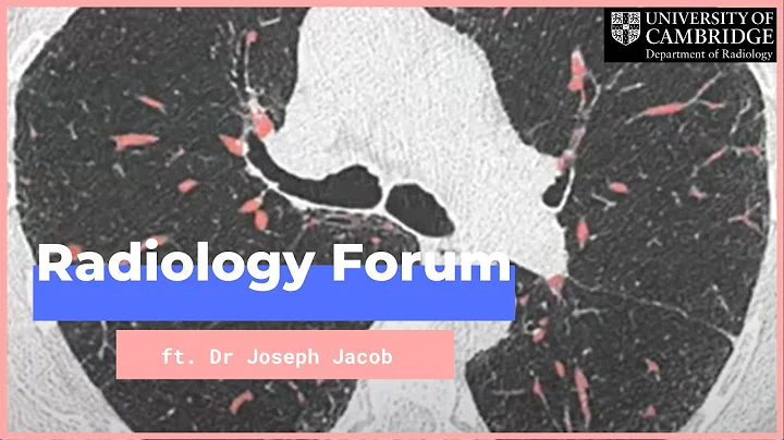 'Computer Analysis of Fibrosing Lung Diseases' by ...