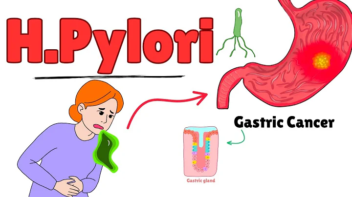 Understanding Helicobacter pylori infection: Symptoms, Diagnosis & Treatment