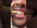 El antiguo cepillo de dientes que aún se usa hoy