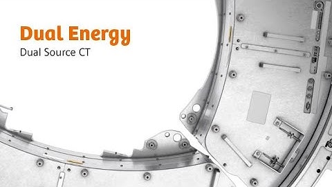 Computed tomography: Dual Source CT - Dual Energy