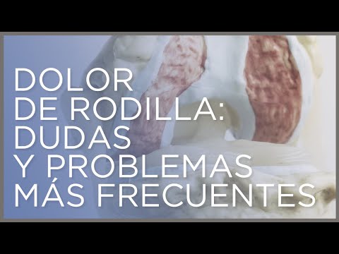 Dolor de rodilla: dudas y problemas más frecuentes