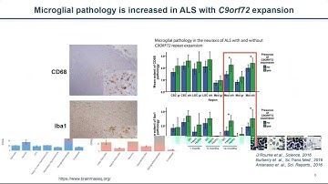 Emerging role of neuroinflammation in C9orf72-ALS