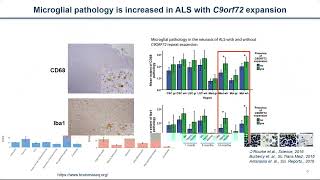 Emerging role of neuroinflammation in C9orf72-ALS