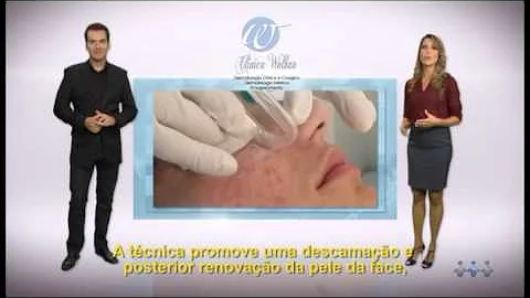 Qual a função do microdermoabrasão da mary kay?