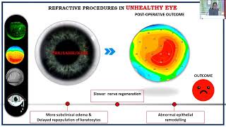 AIOC2026   IC408   T Dr Abha Shah   Ocular Surface Challenges After Refractive Surgery  Diagnosis to