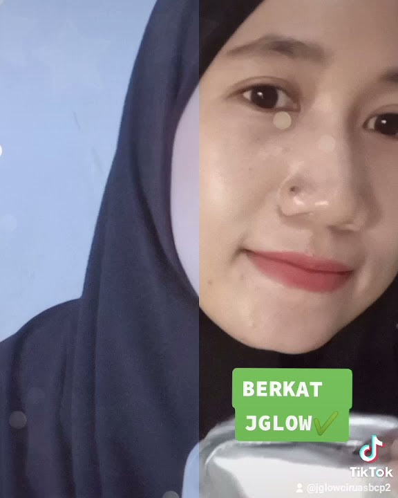 Cerah Sehat Alami Hanya Dengan JGlow Skincare Cream Jglow Aman BPOM Halal dan BerKlinik