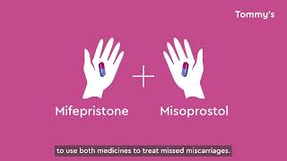 MifeMiso: medical management of missed miscarriage - breakthrough research by Tommy's