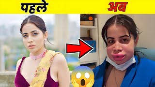 10 सेलिब्रिटीज जिनकी सर्जरी ने बर्बाद कर दिया चेहरा | Before &amp; After Shocking Pics |
