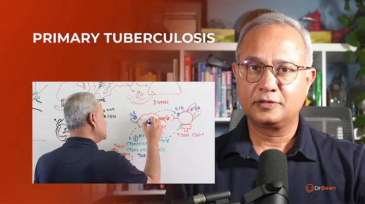 Primary Tuberculosis