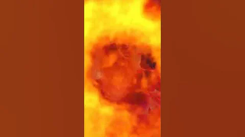 Man on fire in Orlando Burns and survives