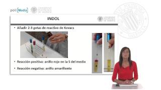 IMVIC: Indol, Rojo de metilo, VogesProskauer, Citrato |  | UPV