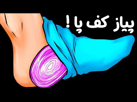 تصویری: چگونه بوی پیاز را از بین ببریم