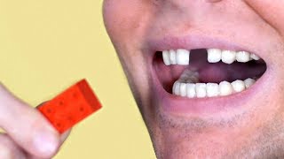 Lego Toy Breaks Tooth