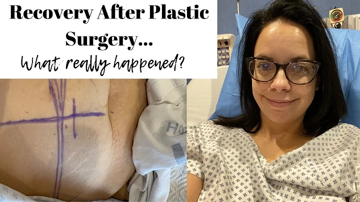 PLASTIC SURGERY AFTER WEIGHT LOSS...WHAT WAS THE R...