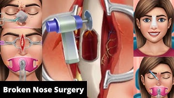 Broken Nose Surgery || ASMR || Doctor