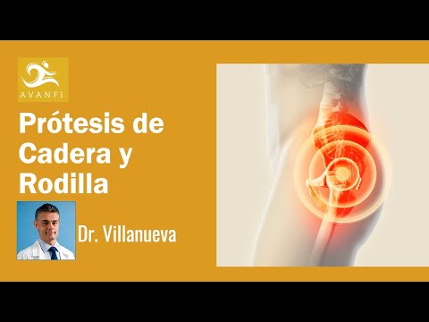 Prótesis de Cadera y Rodilla por el Especialista en Casos Complejos Dr. Villanueva