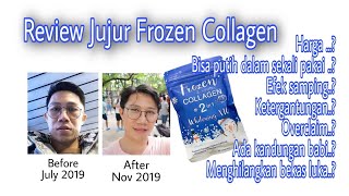 Review Jujur kapsul pemutih Frozen Collagen 2 in 1 | putih dalam sekali pakai ?