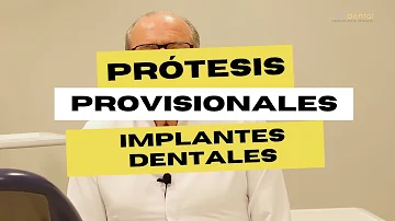 ¿Te ponen dientes provisionales mientras esperas los implantes?