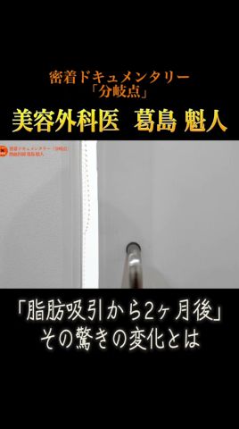 2ヶ月でお腹がこんなに？ミドル世代のお腹の脂肪吸引の現実