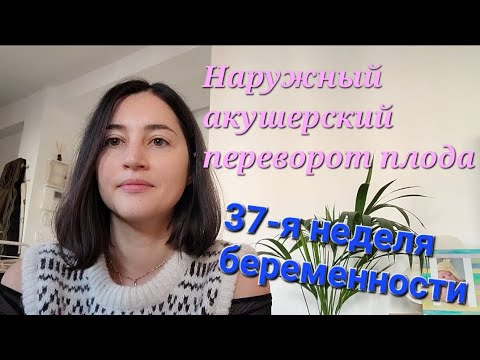 Тазовое предлежание плода. Наружный акушерский переворот в 37 недель. Моя история. Бременность.