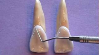 Maxillary Central Incisor  Anatomy