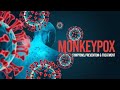 Don't Miss These Critical Monkeypox Warning Signs