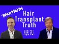 Hair Transplant Truth?- The Bald Truth - August 18th, 2023