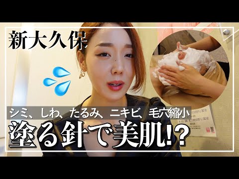 【新大久保】痛い美肌エステは効果抜群‼️塗る針マイクロニードルエステ受けてきた🔥【割引あり】
