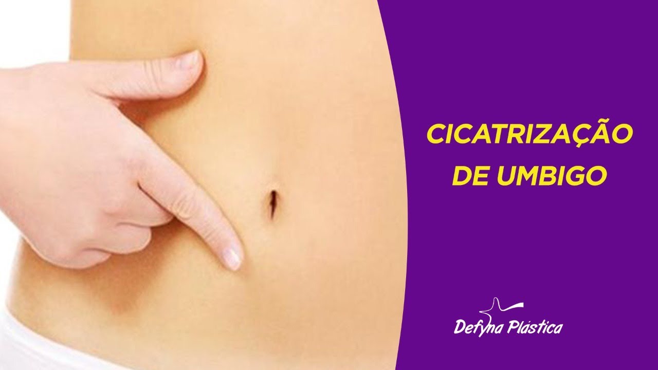 CICATRIZAÇÃO DE UMBIGO APÓS ABDOMINOPLASTIA - YouTube