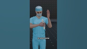 How Strong Are Your Bones Really? 🦴