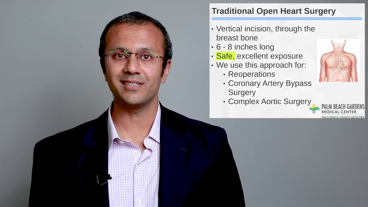 Minimally Invasive Cardiac Surgery - Without Separating the