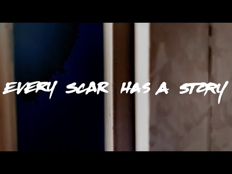 Every Scar Has A Story "Move On" (Lyric Video)
