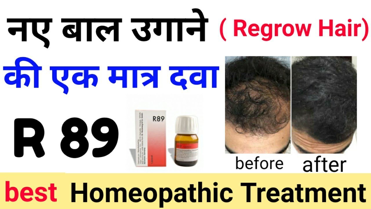 How to regain Hair through Homeopathy Treatment and Medicines