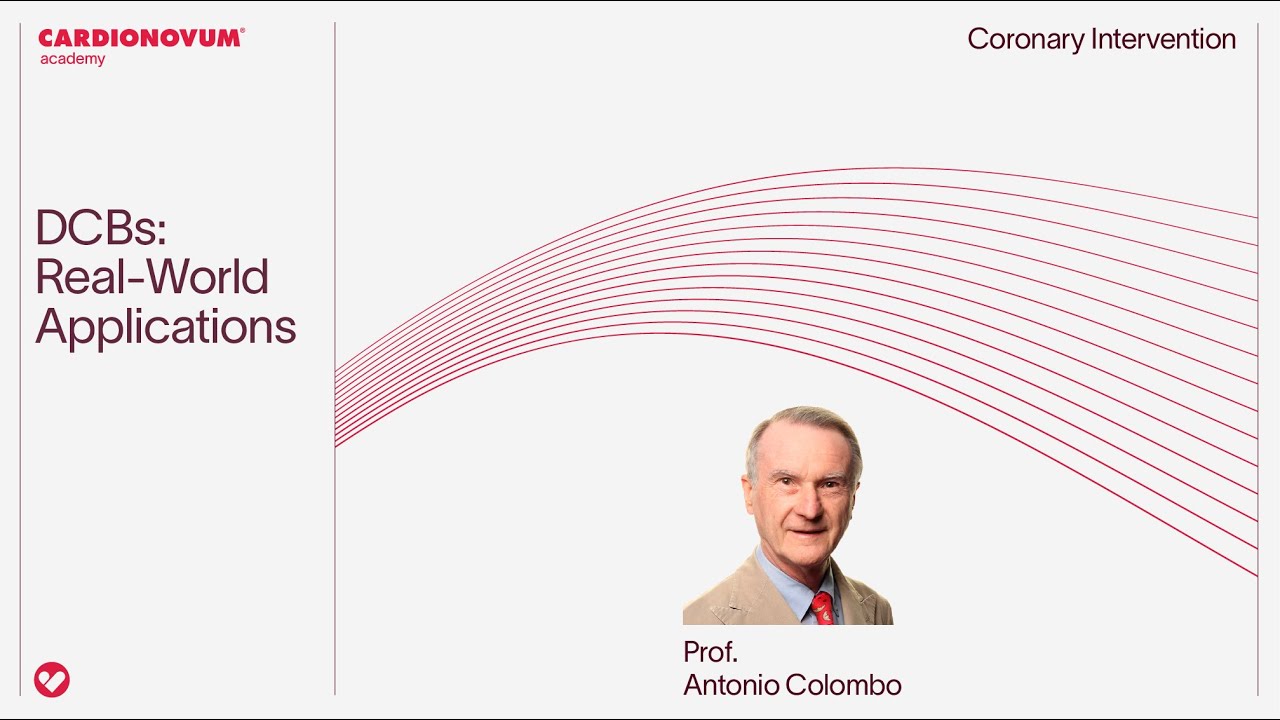 DCBs When to use them? Real cases as example
