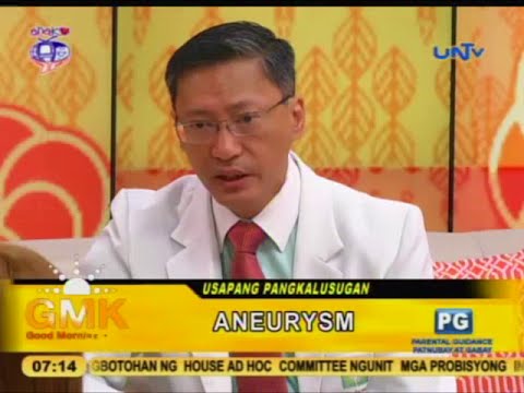 Video: Umalis ba ang warts?