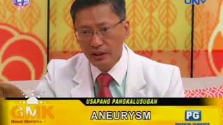 What is Aneurysm?