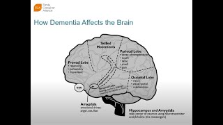 2023-1014 Communication Challenges for Dementia and Psychosis - Christina Irving, LCSW