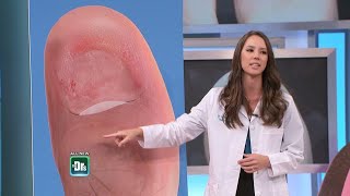 What To Do if Your Toenail Falls Off