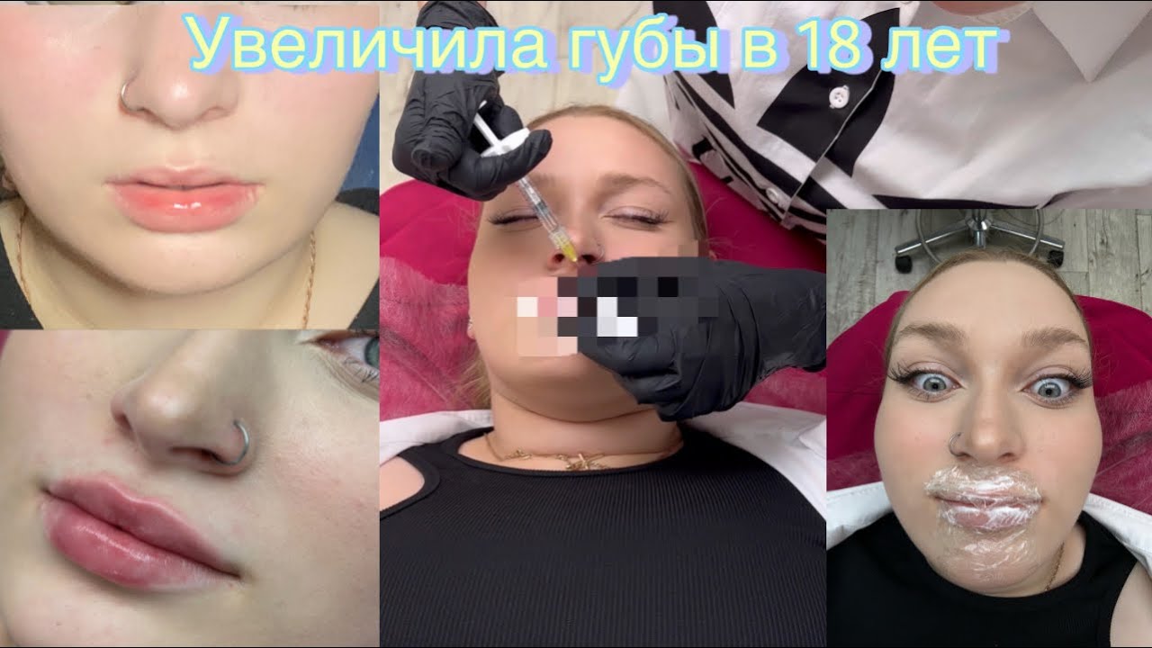 Увеличила губы/Влог из жизни/Практика в банке/Колледж