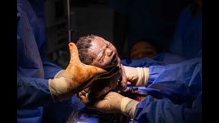 Lindo Parto Da Raquel