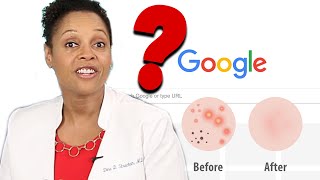 Doctors Answer Commonly Googled Questions About Skin Care