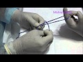 How to tie mishras knot for laparoscopic surgery