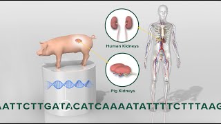 Pigtohuman kidney transplant 3D animation