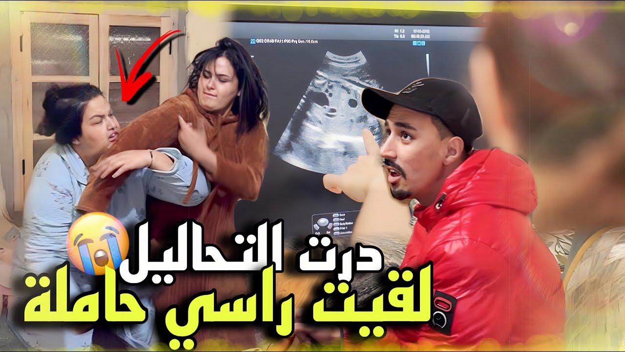 Samia درت تحليلة الدم لقيت راسي حاملة ماعرفت ماندير صدموني بردة فعلهم 😭