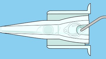 Sensar de Johnson & Johnson