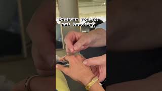 Distal acupuncture for hamstring injury