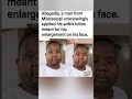 "Talk about an unexpected face lift! 😂🍑#trending #funny #viral